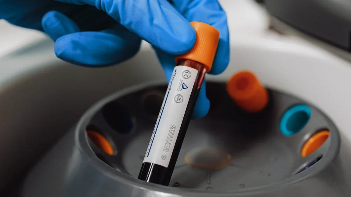PFAS Detected in Nearly Every US Blood Sample, Study Finds