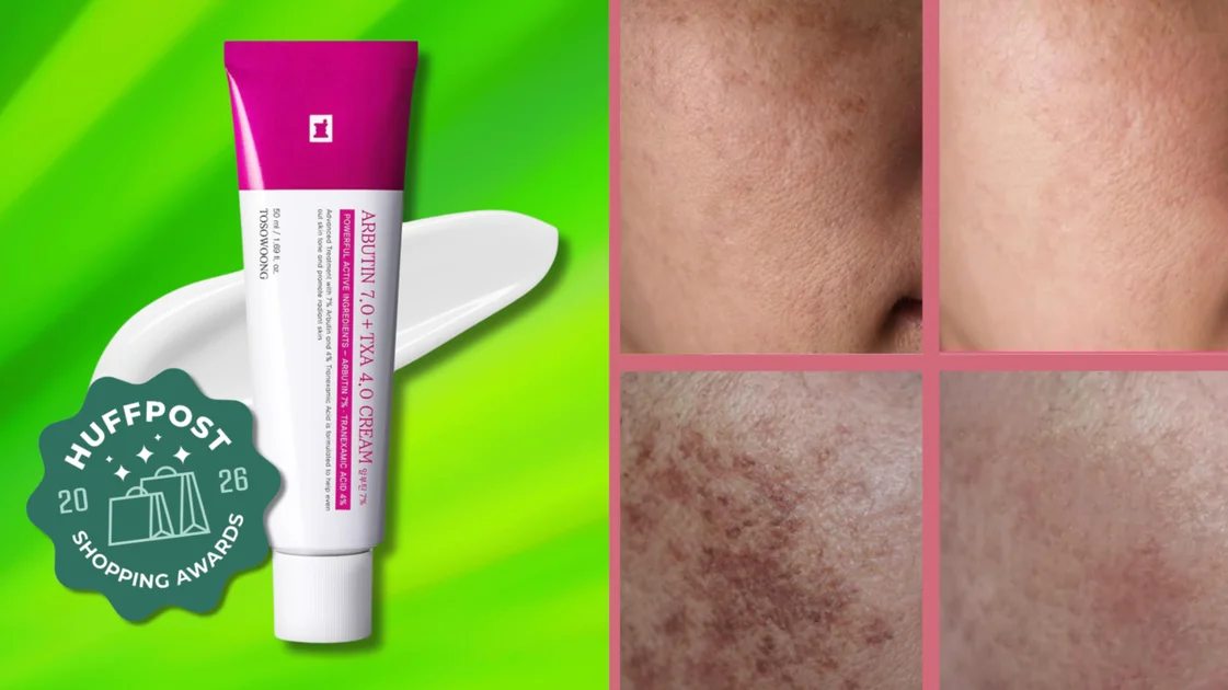 Korean Brightening Cream Slashes Melasma at 30% Off