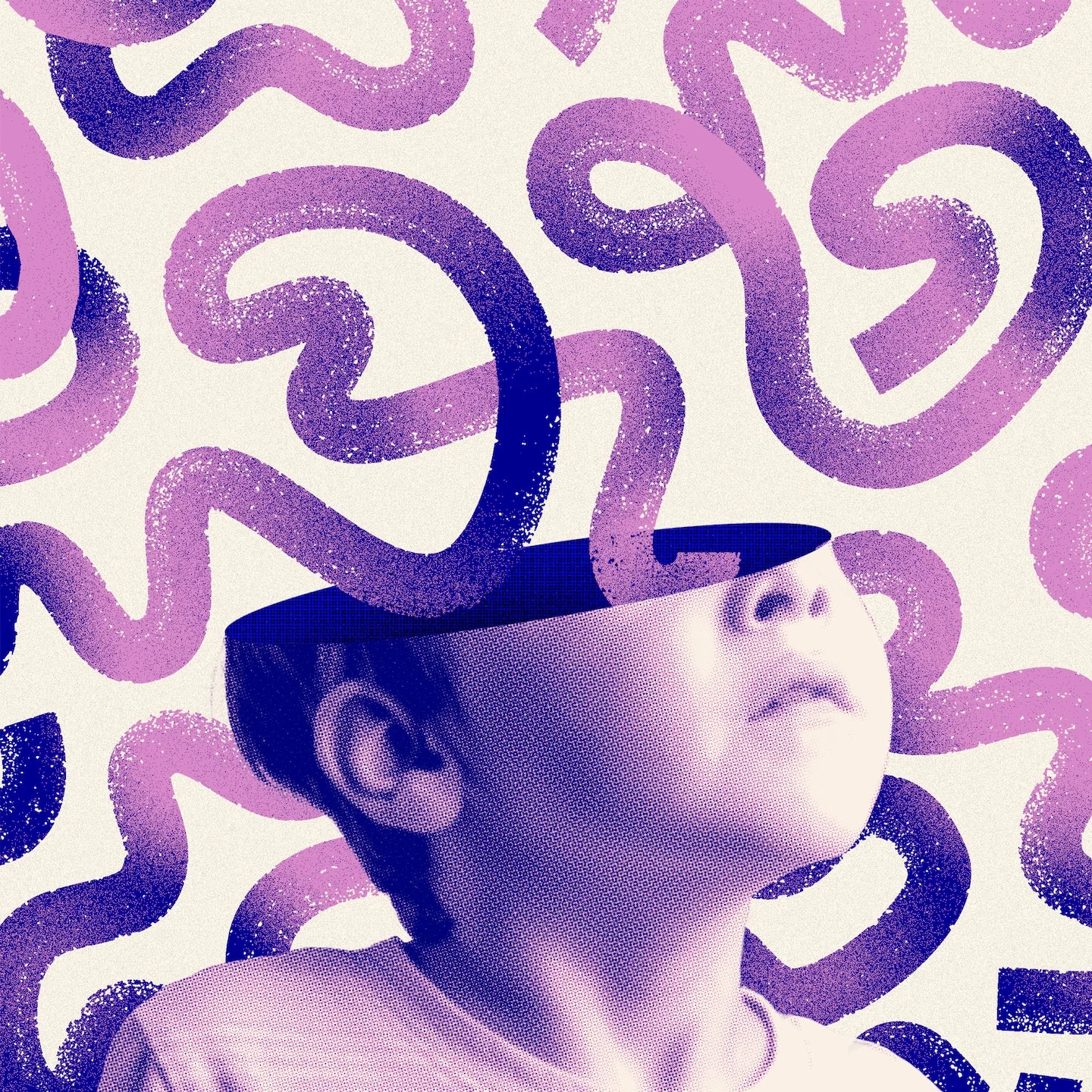 Brain scans identify a severe ADHD subtype defined by emotional dysregulation
