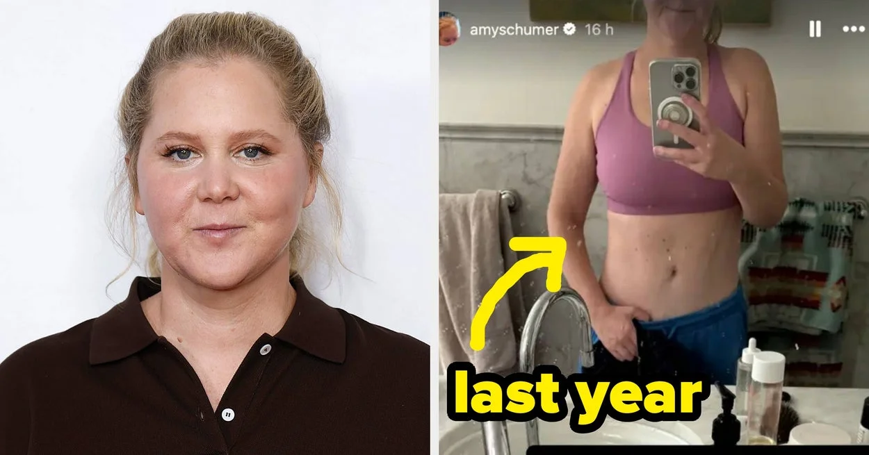 Amy Schumer Flaunts Unfiltered Bikini Pics After Year on Mounjaro