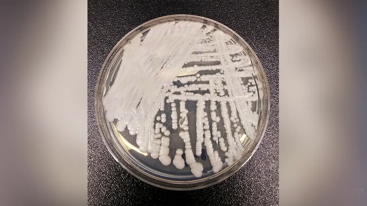 Rapid Spread of Deadly Fungus Raises Global Health Concerns