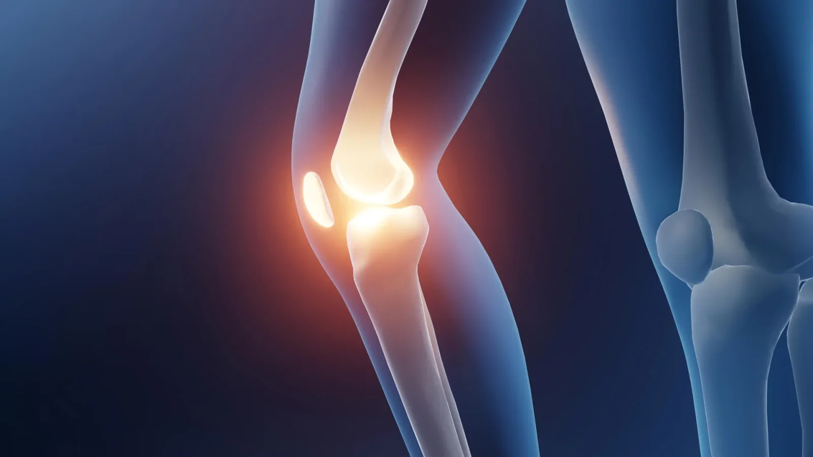 Aerobic Exercise Emerges as Top Pain Reliever for Knee Osteoarthritis