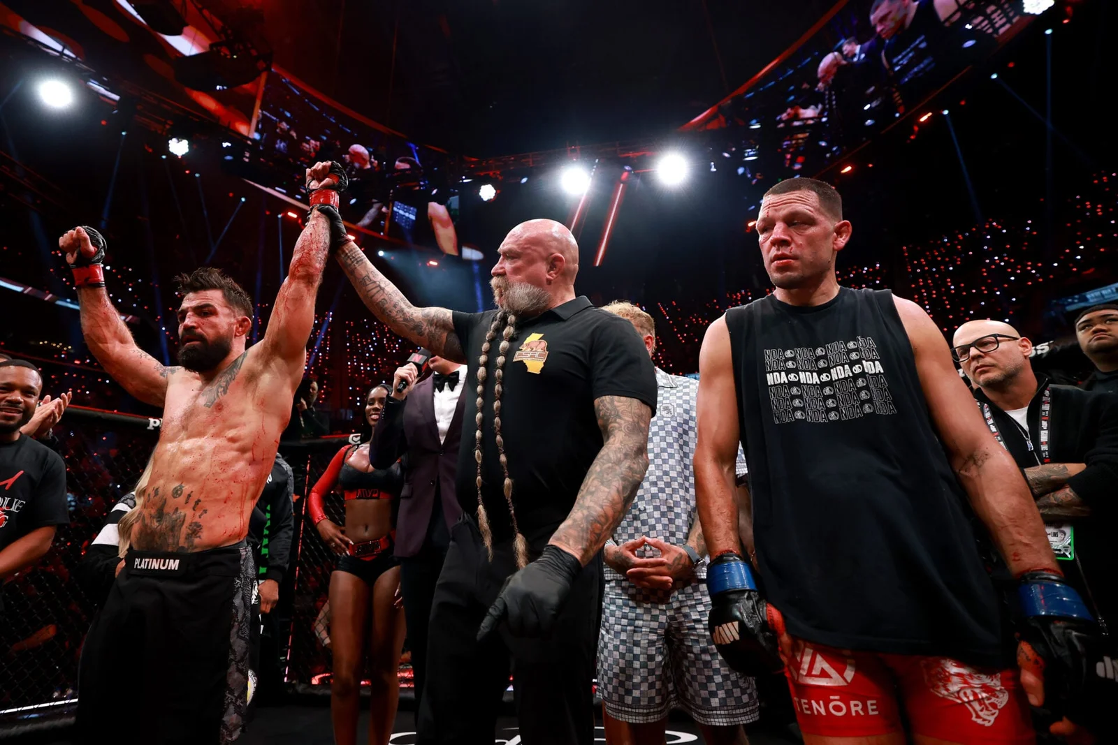 Diaz admits rust showed in Netflix return against Mike Perry