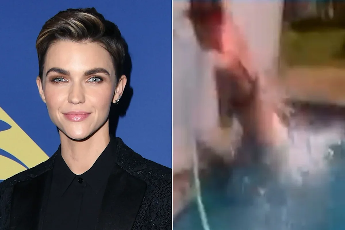 Ruby Rose Faces Weeks of Recovery After Home Pool Accident
