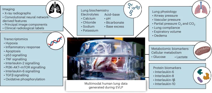 Personalized digital twins forecast lung fate during ex vivo perfusion