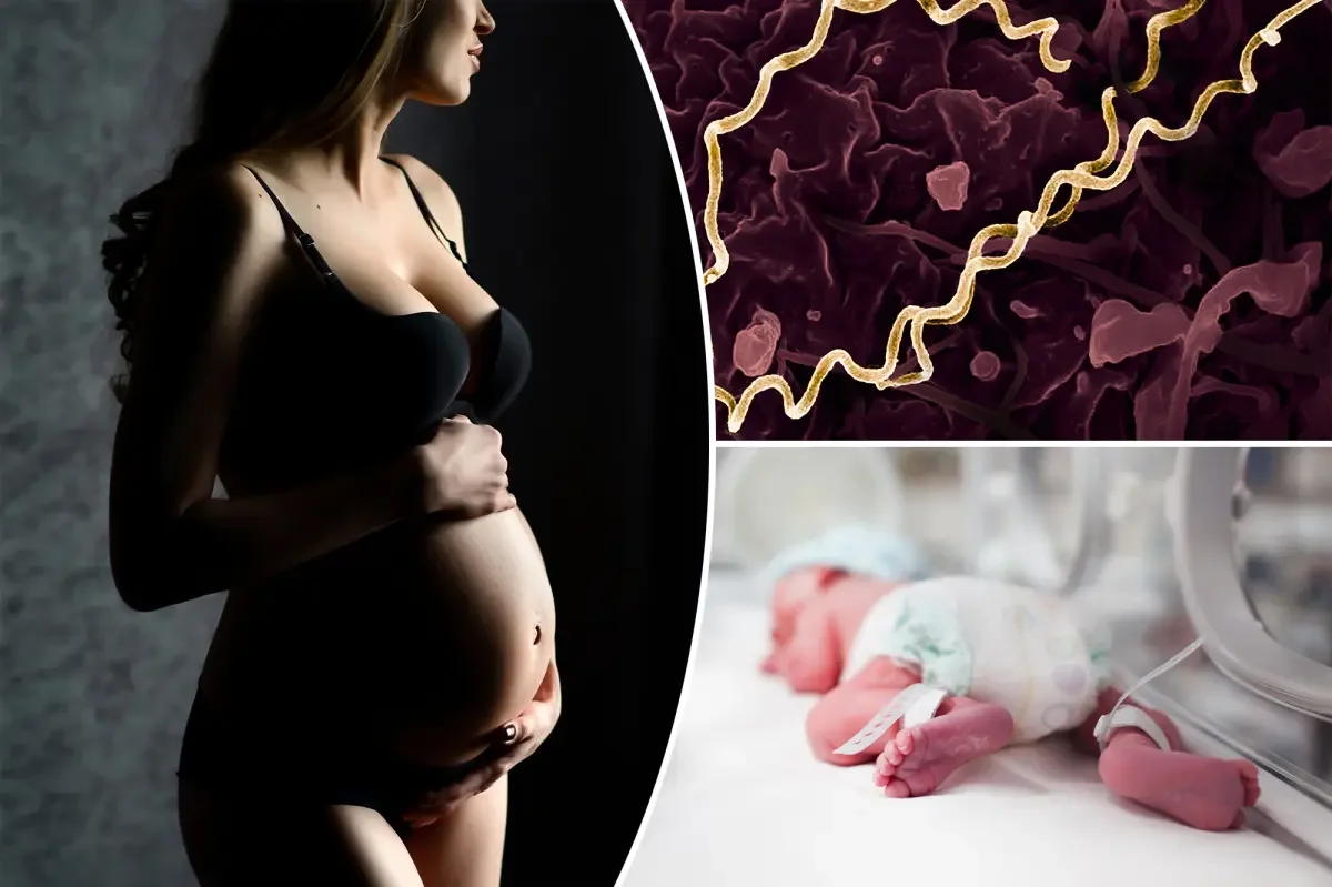 Congenital syphilis spike triggers infant deaths in Australia amid US surge