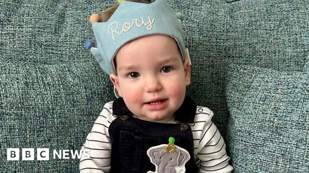 Groundbreaking nitinol-spring surgery reshapes baby’s skull in rare craniosynostosis case