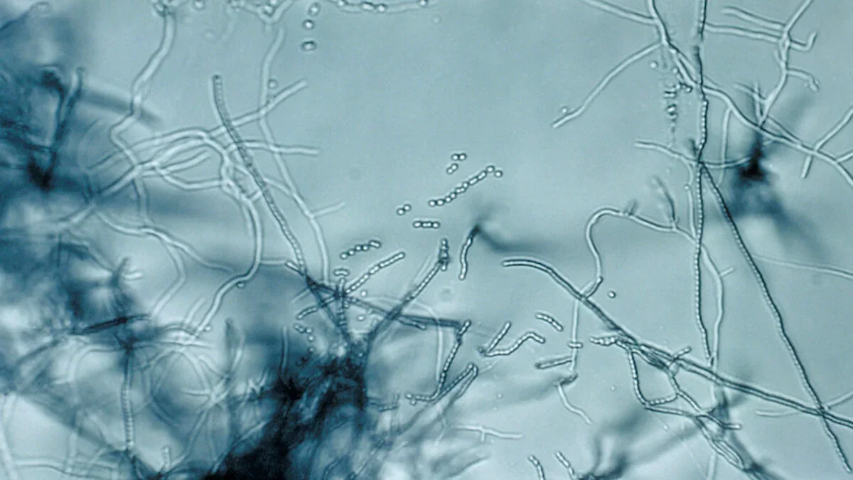 Soil-born antibiotic hits a novel ribosome site to tackle resistant bacteria