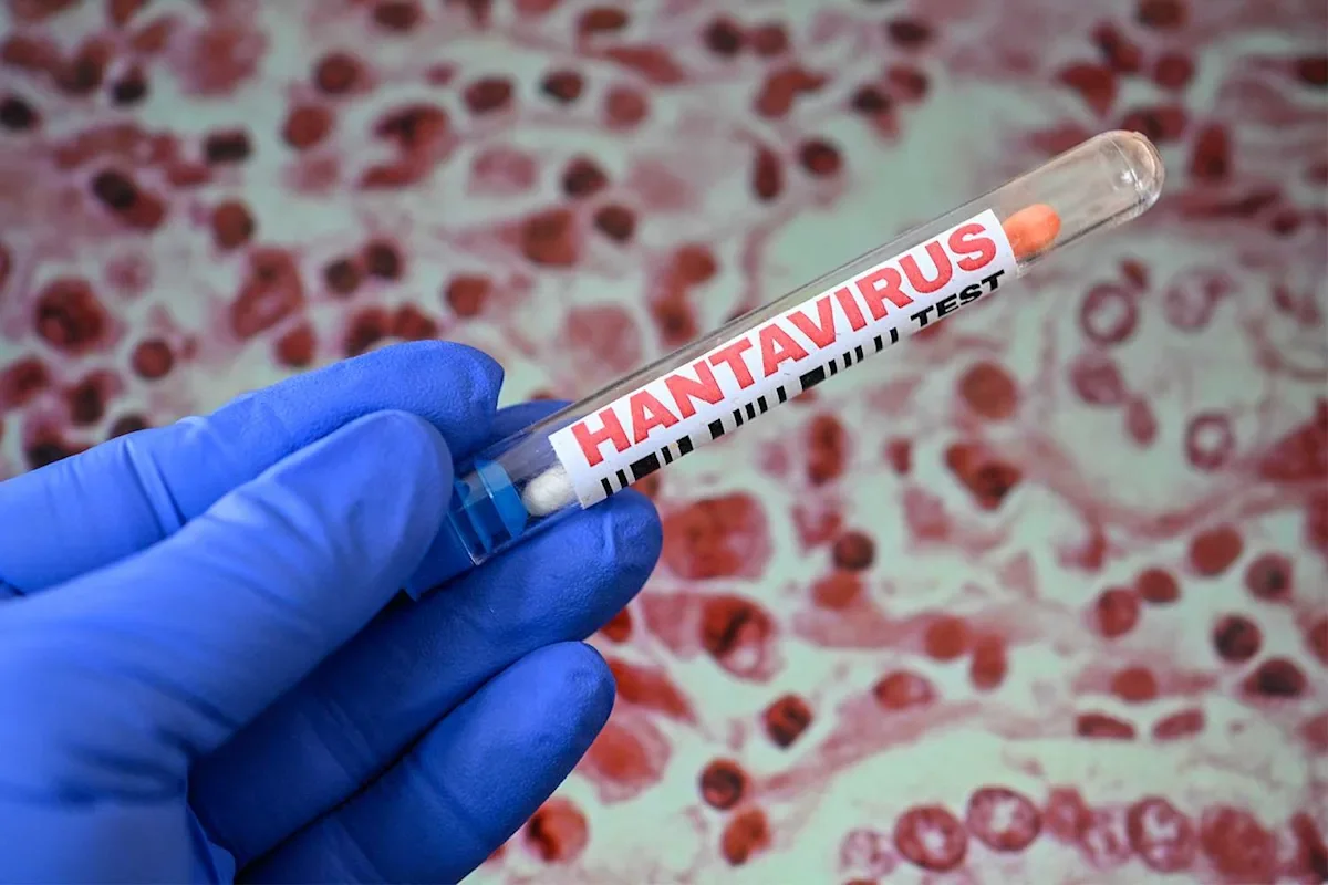 Colorado Reports hantavirus Death as State Launches Investigation