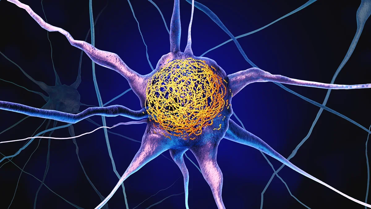 Midlife Vitamin D Linked to Lower Tau Buildup in Brain