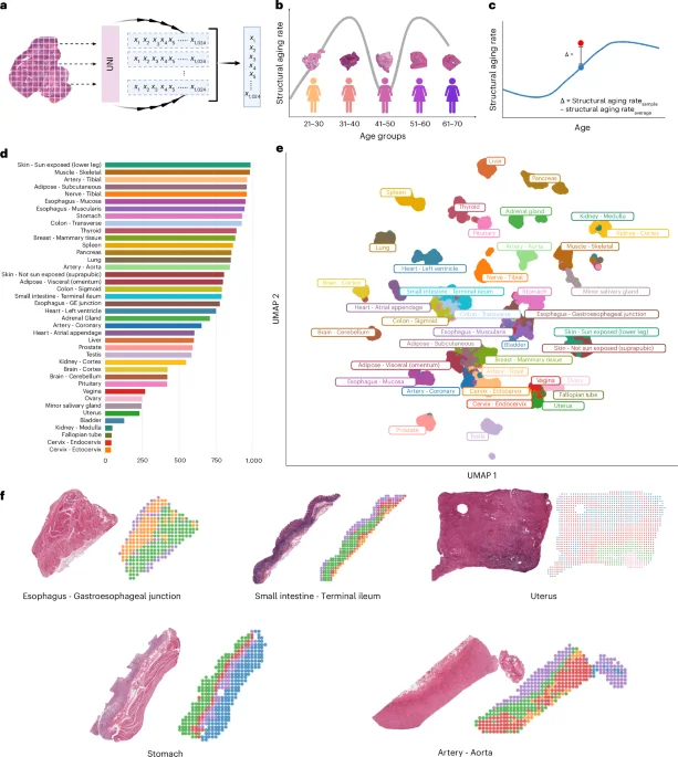 PathStAR maps organ-specific aging timelines and coordinated tissue decline