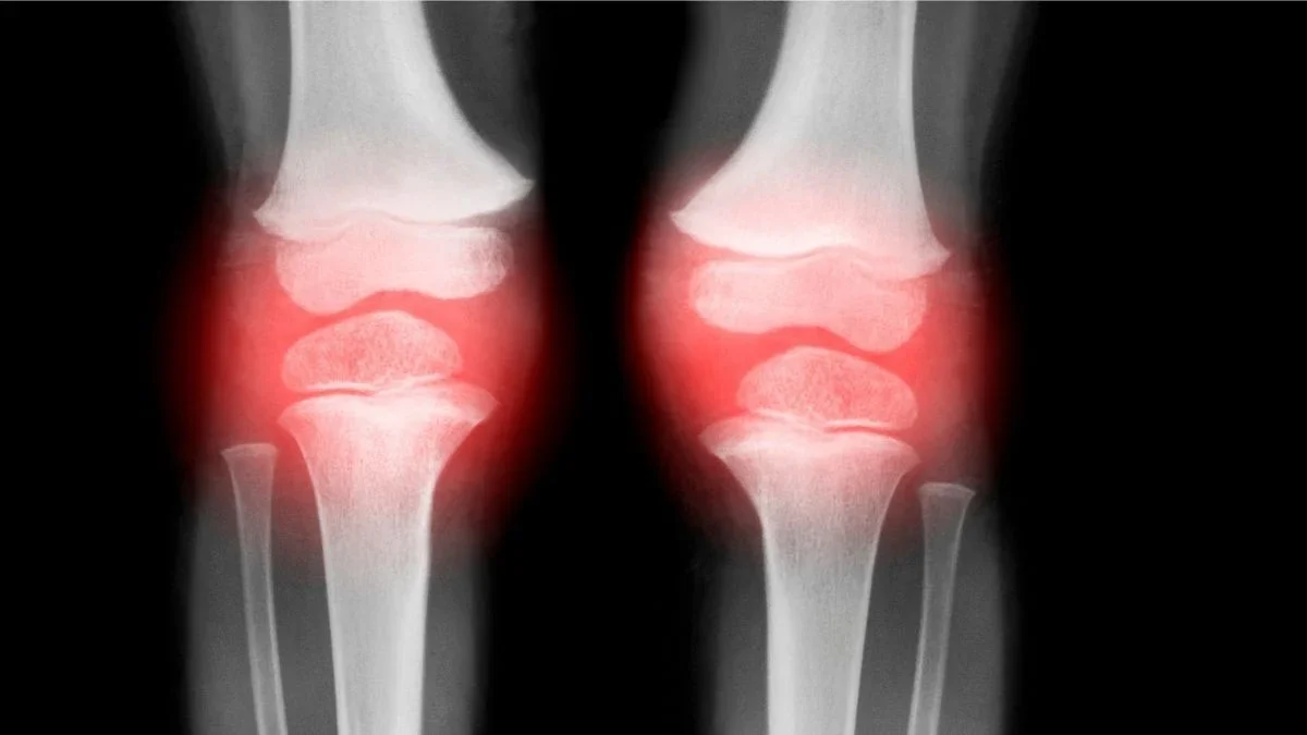 Blocking 15-PGDH May Rebuild Aging Cartilage and Ease Osteoarthritis