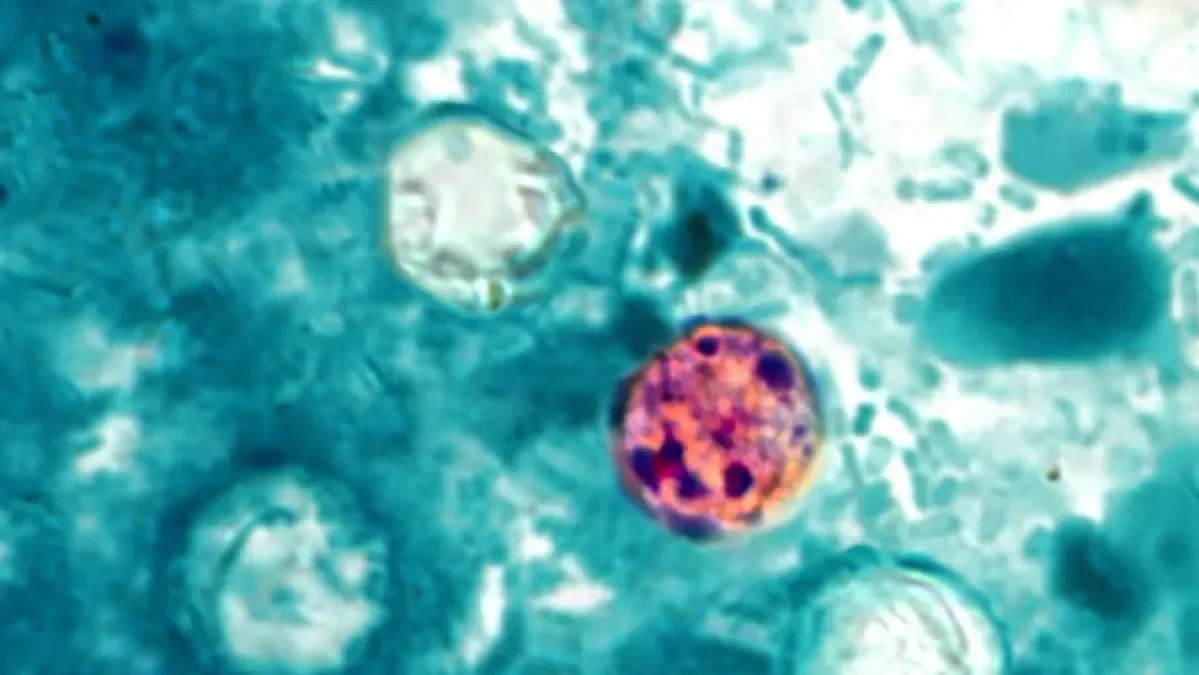 Michigan confronts a rapidly growing cyclosporiasis outbreak across 21 counties
