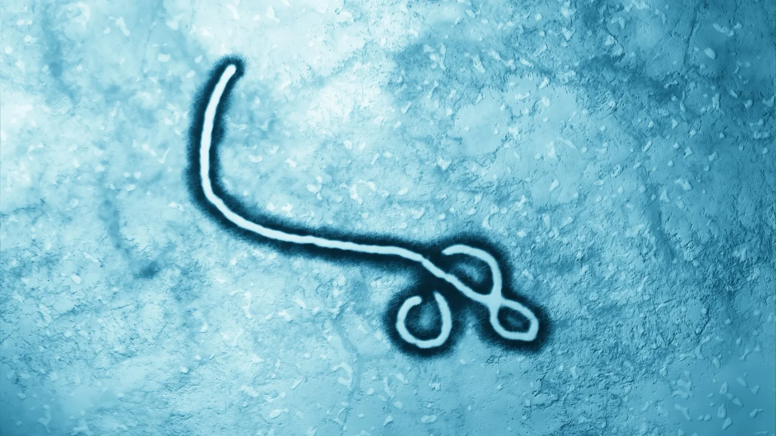US Enlists San Diego Biotech for Experimental Ebola Antibody Therapy
