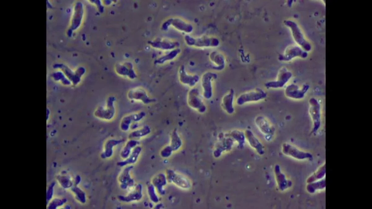 Central NC Teen Critically Ill from Rare Brain-Eating Amoeba