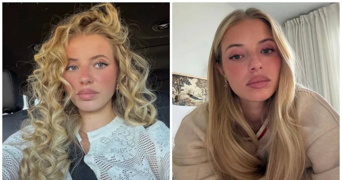 Rhinoplasty Drip: Influencer’s Nose Leaks Post-Surgery, Prompting Medical Caution
