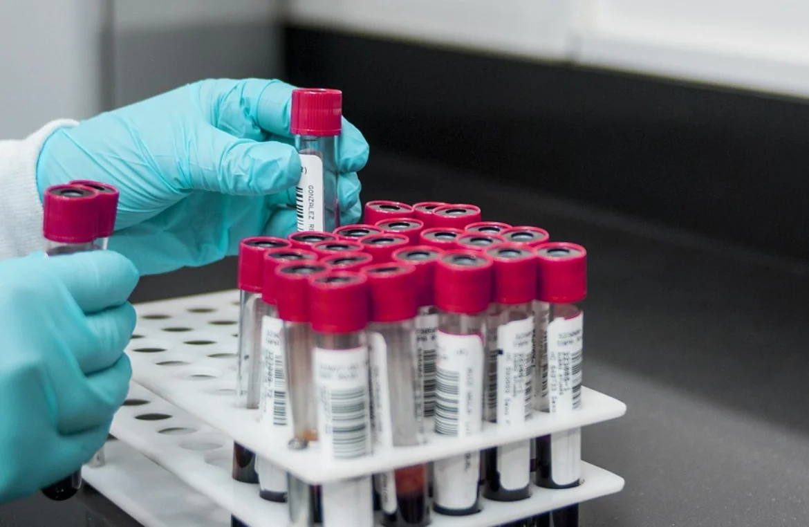 New Cholesterol-Lowering Pathway Uncovered, Points to CTSA-Targeted Therapy