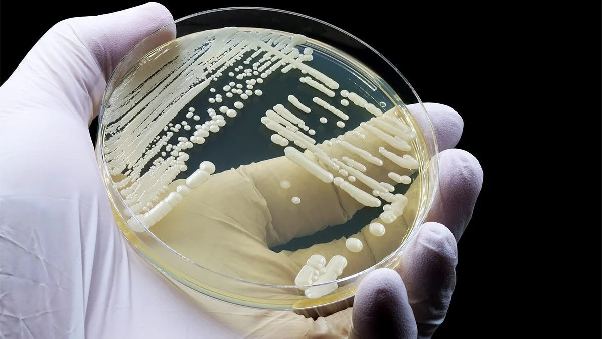 California Faces Surge of Drug-Resistant Candida auris in Hospitals