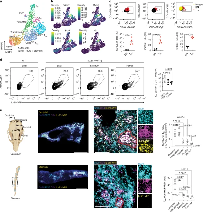Brain-border immune hubs: skull bone marrow hosts germinal-center–like niches that surveil the CNS and boost anti-tumor immunity
