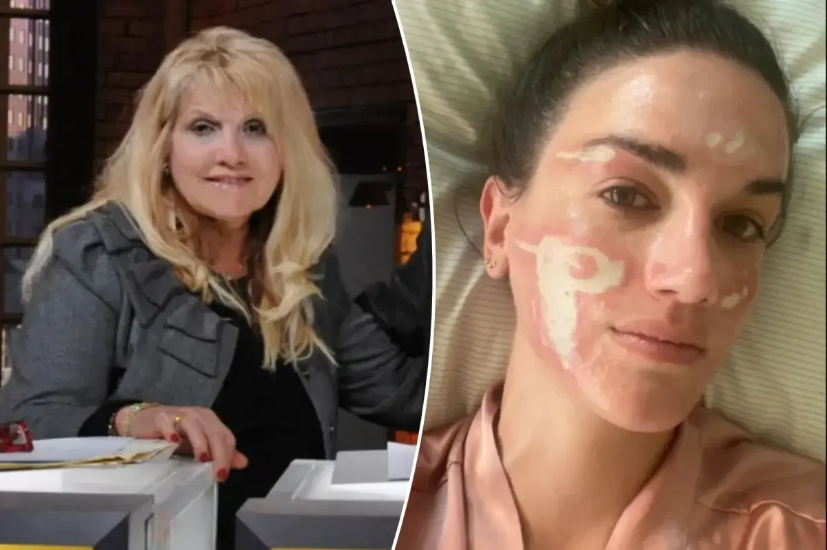 Celebrity esthetician surrenders license amid client’s claim of permanent facial scarring