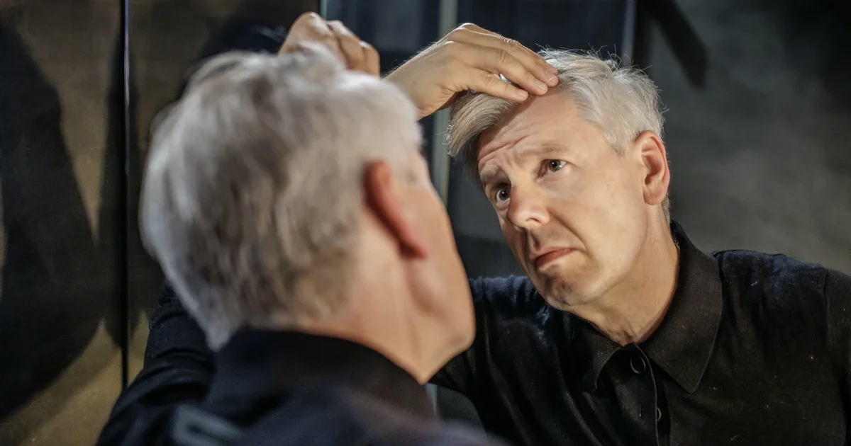 Some men on GLP-1 weight-loss meds may face persistent hair shedding, study finds