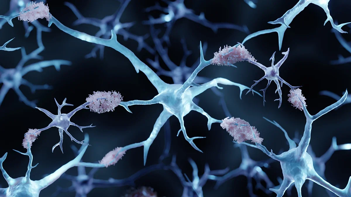 Copper drug reboots brain cleanup pumps to cut Alzheimer's proteins in mice