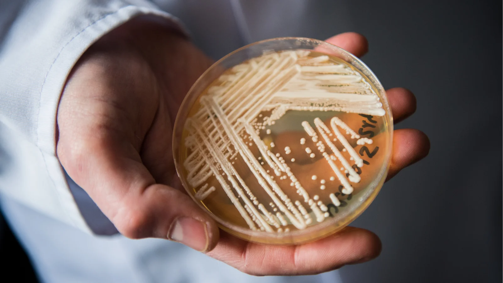 Candida auris cases reach 3,130 in 23 states, CDC reports