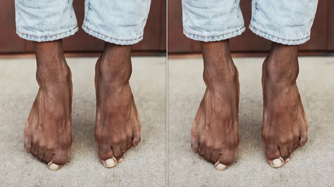 Toe Hair: A Subtle Health Clue Hidden On Your Feet