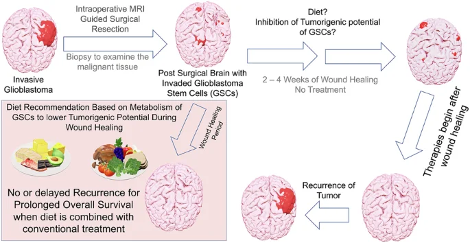 Low-carb, high-fat diet throttles glioblastoma by redefining tumor lipids and stem-cell metabolism