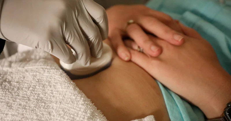 Abortion bans linked to slower, less evidence-based miscarriage care