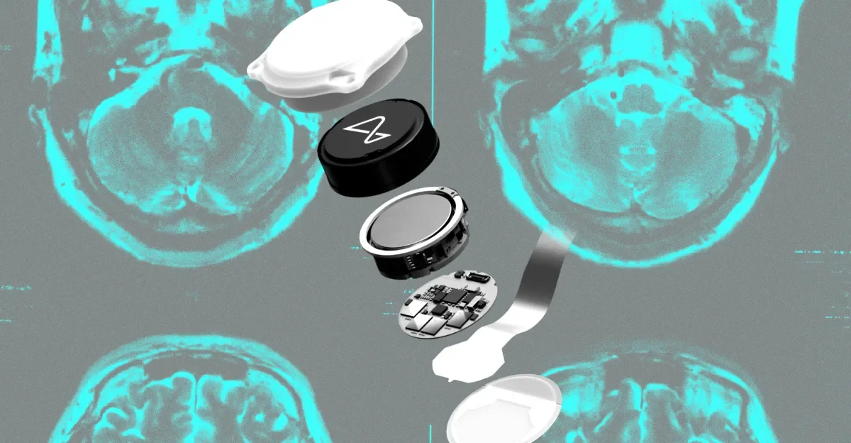 Neuralink shifts to speech BCIs as rivals race ahead