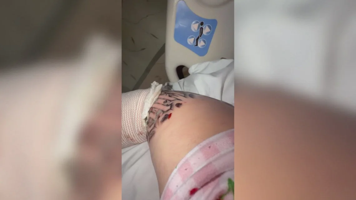 Instagram tattoo from online artist leads Arizona woman to hospital with severe infection