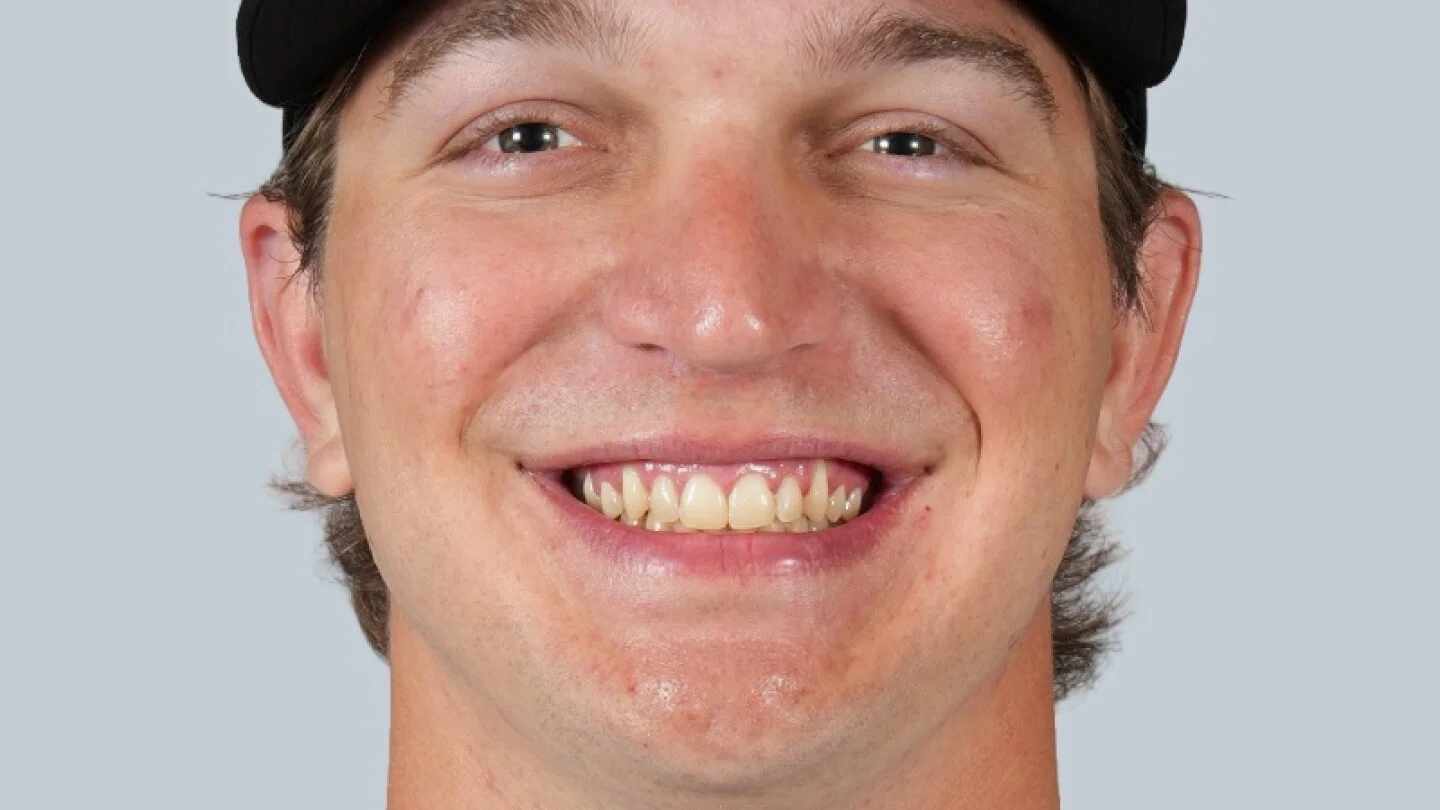 Zac Veen Explodes in Triple-A as Rockies Weigh MLB Opportunity