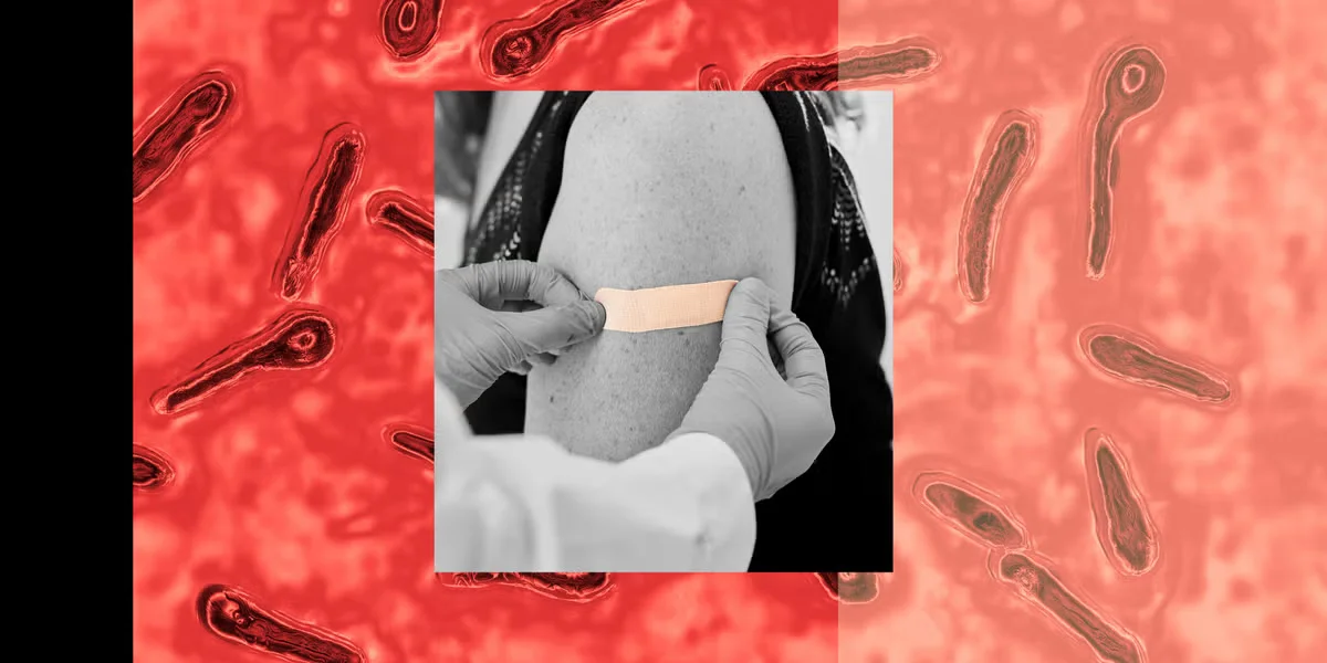Tetanus Cases Edge Up in the U.S. as Vaccination Gaps Reappear