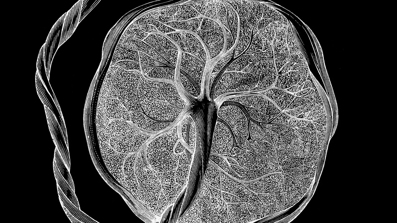 Pregnancy-specific cell type found at maternal-fetal interface may regulate placental invasion