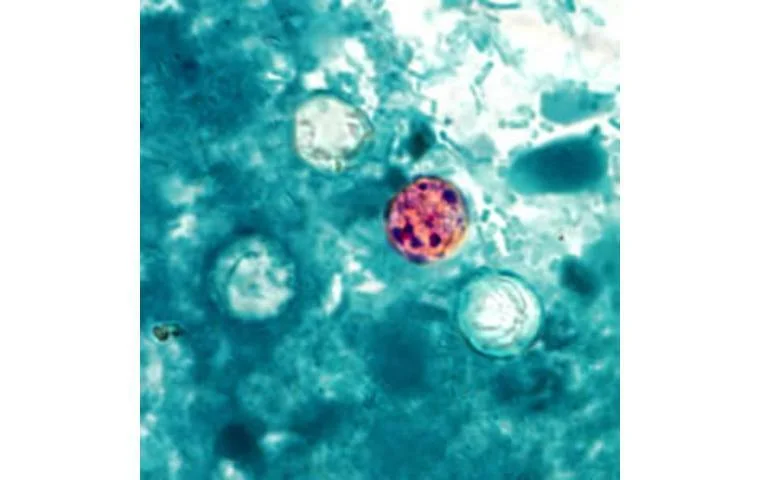 Two travel-linked cyclosporiasis cases reported in Hawaii
