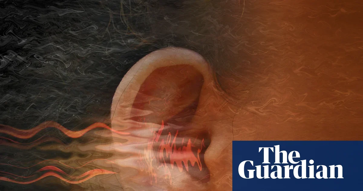 Tinnitus relief: a multi-pronged plan for habituation and calm