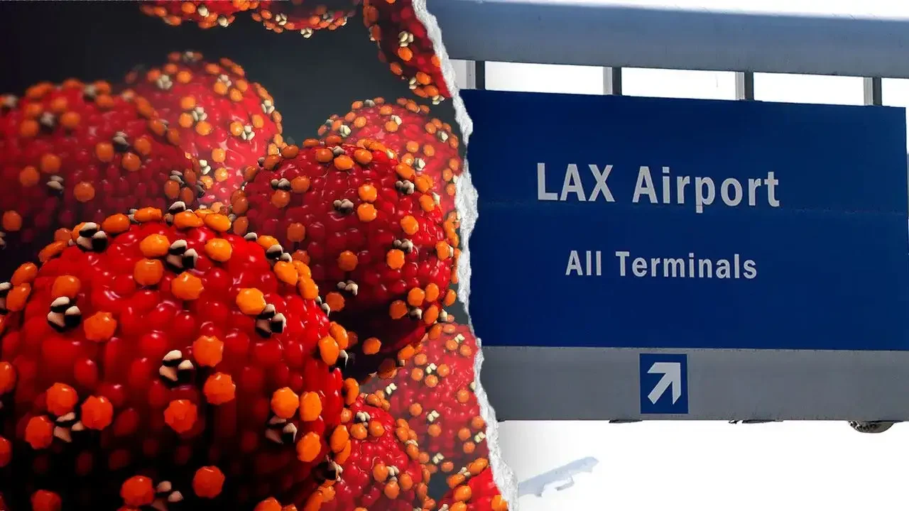 Measles exposure prompts health alert at LAX and Hilton after June flight