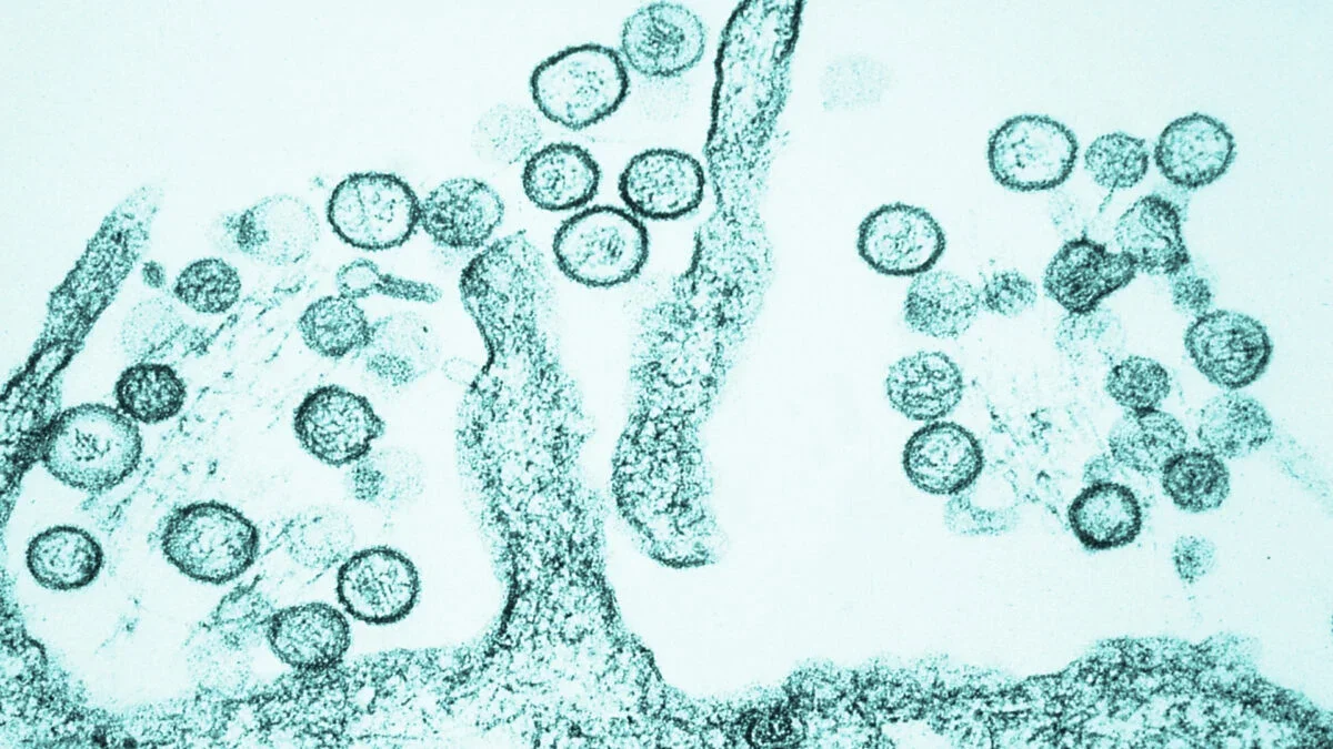 Colorado Records Its First hantavirus Death Since 2024 Amid Spring-Rodent Advisory