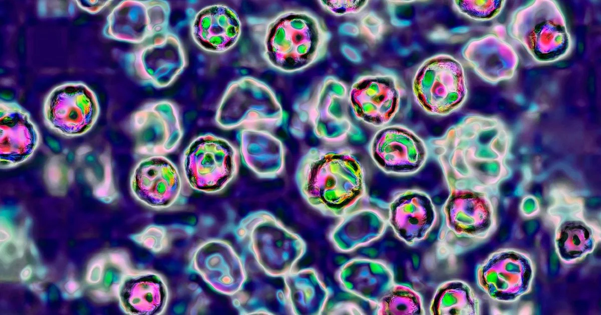 Asheville hotel on alert after possible measles exposure