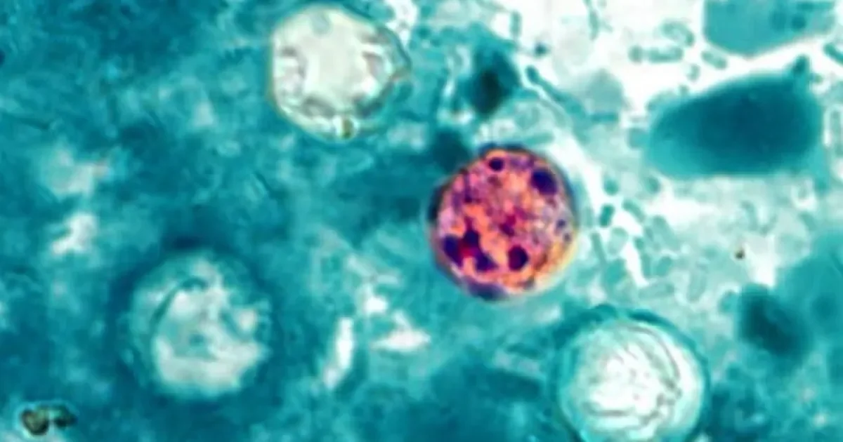 Monroe County probes Cyclospora outbreak amid rising cases