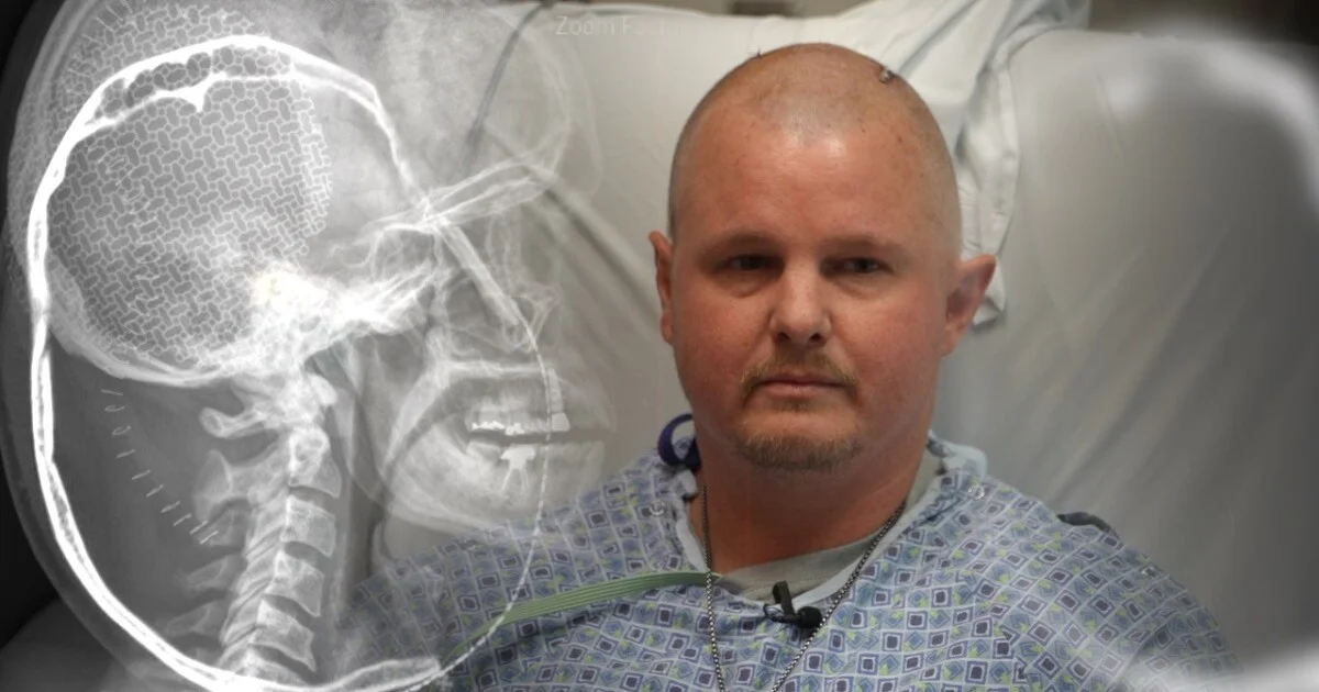 Investigation leads insurer to cover brain-tumor surgery after denial