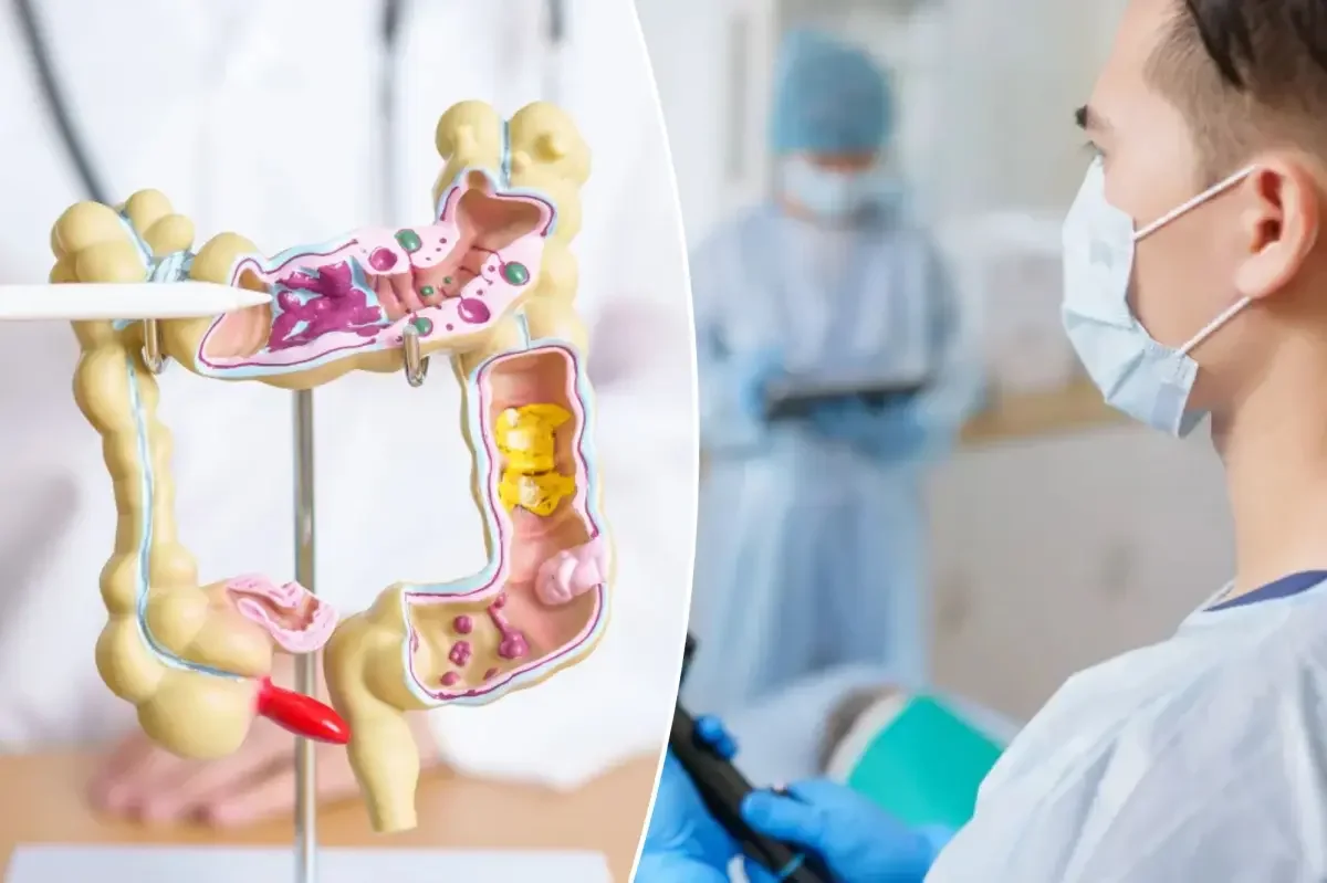 Home-based stool test cuts colon cancer deaths by half, study finds