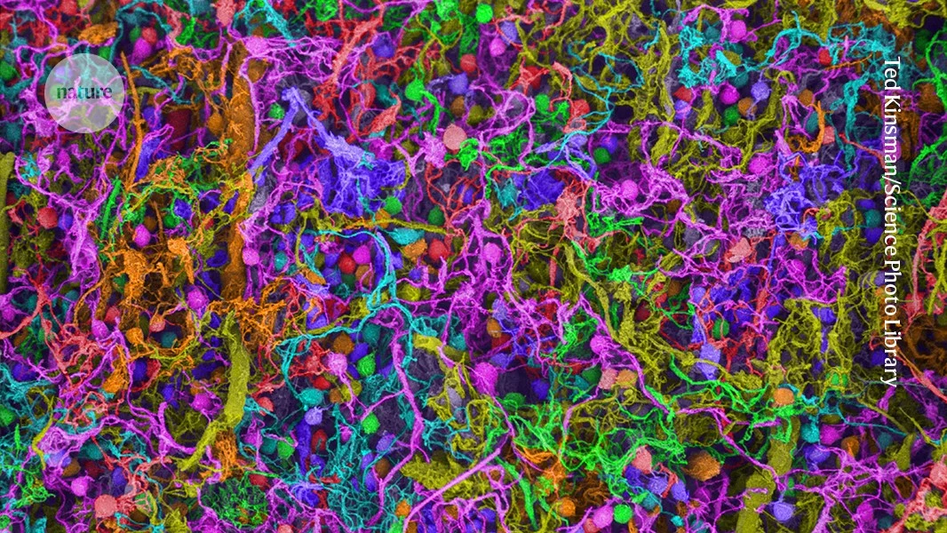 Brain cells map the building blocks of speech