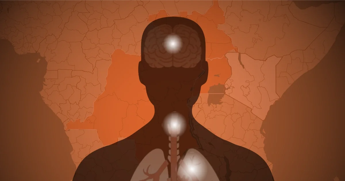 Bundibugyo Ebola in Congo: a rapid 2026 outbreak under global watch