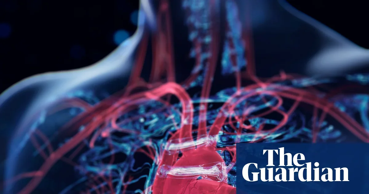 Oxford AI flags five-year heart failure risk from routine CT scans