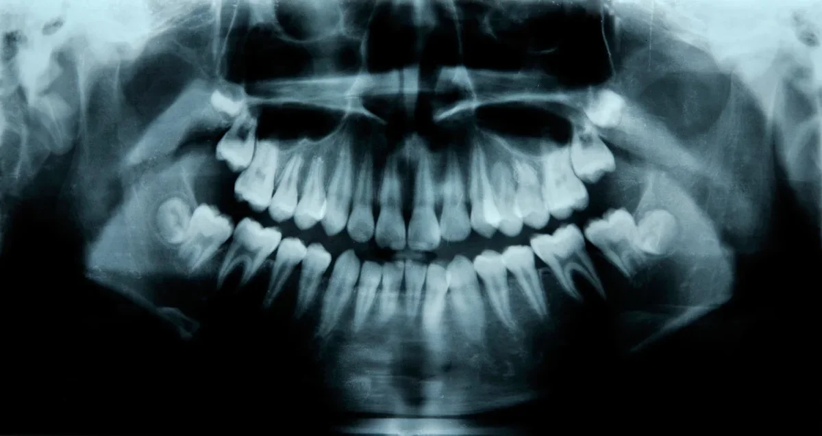 Could Humans Grow a Third Set of Teeth? Early Trial Hints at Possibility