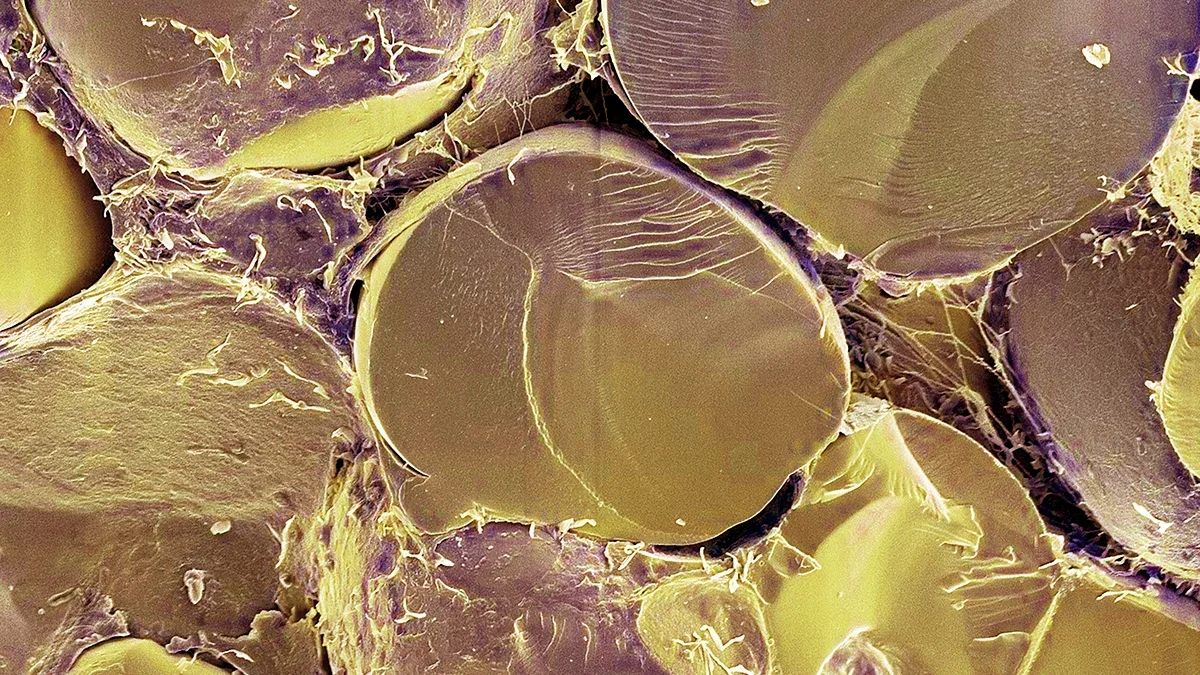 Mitch protein switch makes human cells burn fats for energy, opening obesity research avenue