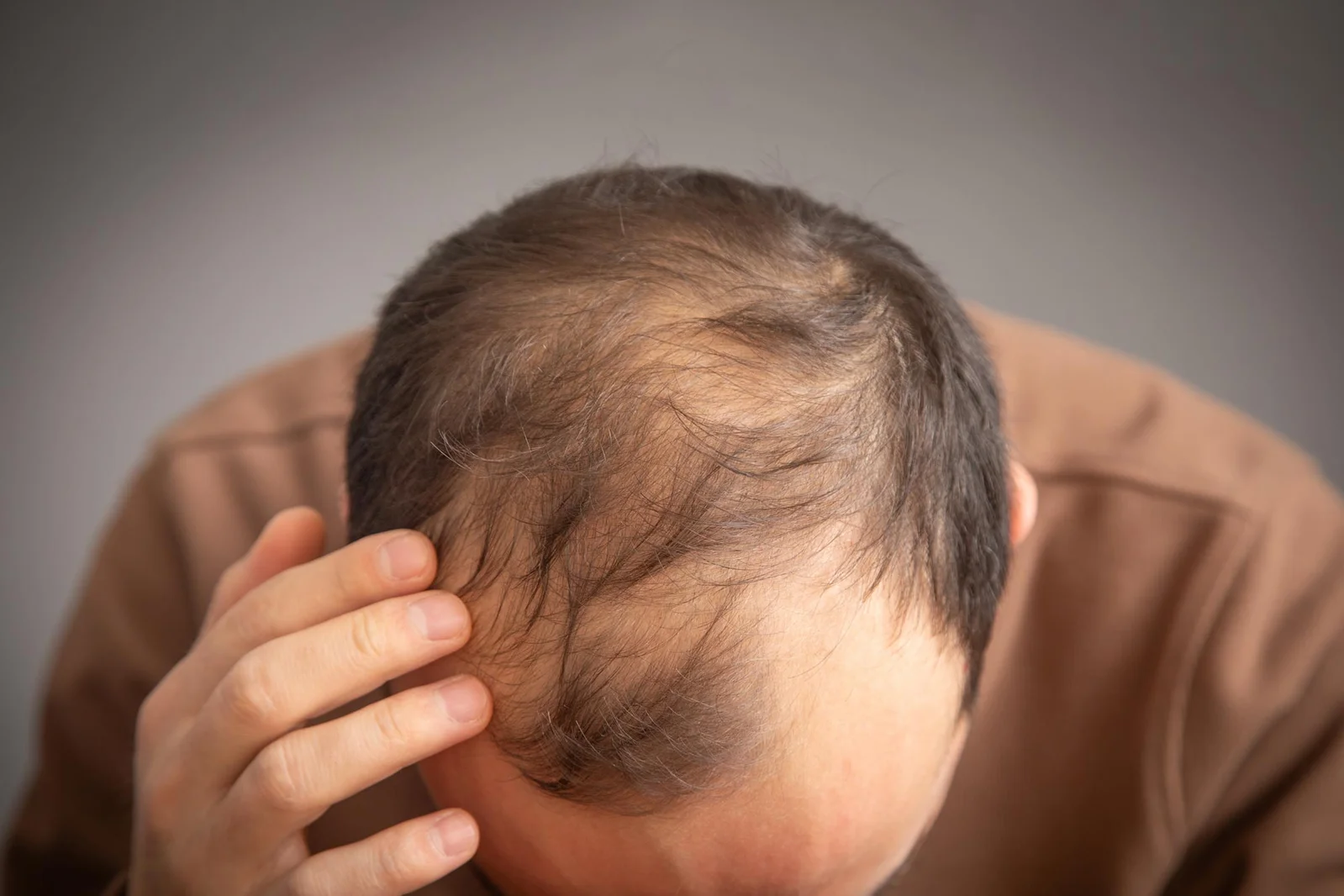 Protector Protein MCL-1 Could Enable Hair Regrowth