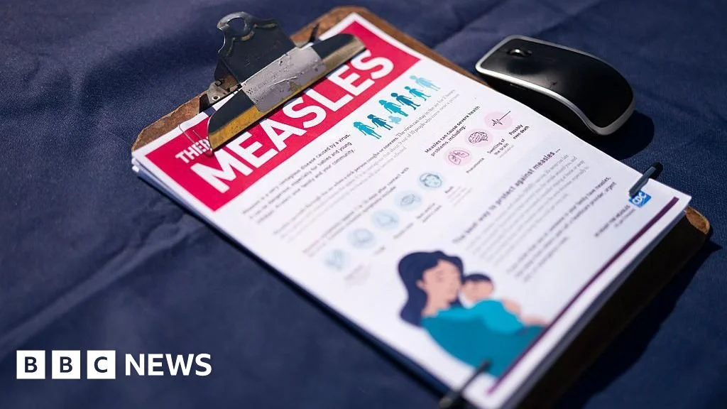 US measles cases surge to 35-year high, prompting elimination-status scrutiny